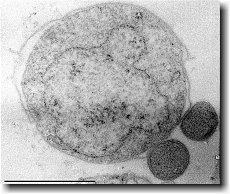 Ignicoccus hospitalis mit angehefteten Nanoarchaeum equitans